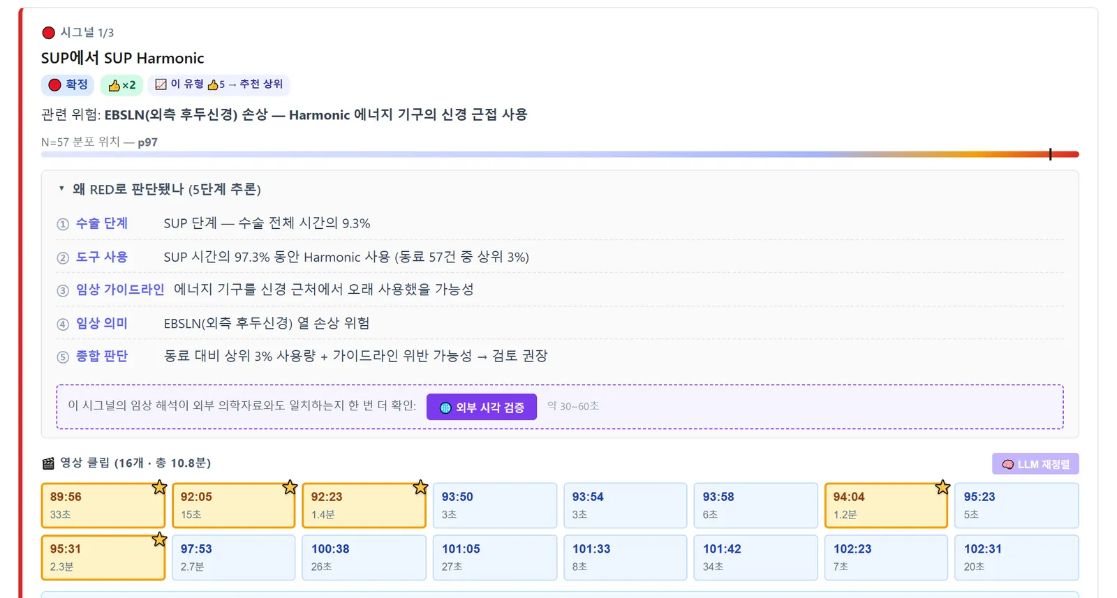 시그널 상세 — 5단계 추론